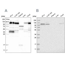 Invitrogen RABEP1 Polyclonal Antibody 100 &mu;L; Unconjugated:Antibodies,