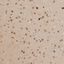 Invitrogen NPAS2 Polyclonal Antibody 100 &mu;L; Unconjugated:Antibodies,