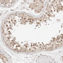 Invitrogen NPAS2 Polyclonal Antibody 100 &mu;L; Unconjugated:Antibodies,