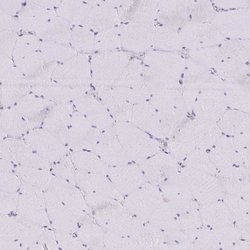 Invitrogen NOV Polyclonal Antibody 100 &mu;L; Unconjugated:Antibodies,