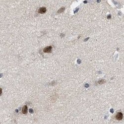 Invitrogen Nuclear Matrix Protein p84 Polyclonal Antibody 100 &mu;L; Unconjugated:Antibodies,