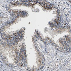 Invitrogen SMU1 Polyclonal Antibody 100 &mu;L; Unconjugated:Antibodies,