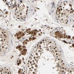 Invitrogen SMU1 Polyclonal Antibody 100 &mu;L; Unconjugated:Antibodies,