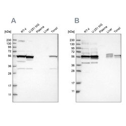 Invitrogen SMU1 Polyclonal Antibody 100 &mu;L; Unconjugated:Antibodies,