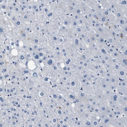 Invitrogen LANCL2 Polyclonal Antibody 100 &mu;L; Unconjugated:Antibodies,
