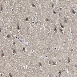 Invitrogen LANCL2 Polyclonal Antibody 100 &mu;L; Unconjugated:Antibodies,