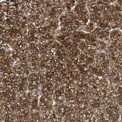 Invitrogen RAB31 Polyclonal Antibody 100 &mu;L; Unconjugated:Antibodies,