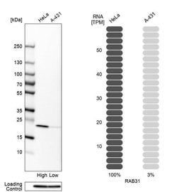 Invitrogen RAB31 Polyclonal Antibody 100 &mu;L; Unconjugated:Antibodies,