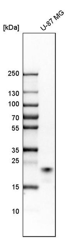 Invitrogen RAB31 Polyclonal Antibody 100 &mu;L; Unconjugated:Antibodies,