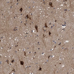 Invitrogen ITFG1 Polyclonal Antibody 100 &mu;L; Unconjugated:Antibodies,