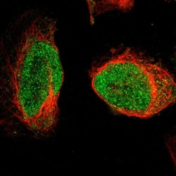Invitrogen ORC5L Polyclonal Antibody 100 &mu;L; Unconjugated:Antibodies,