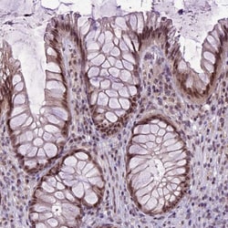 Invitrogen ORC5L Polyclonal Antibody 100 &mu;L; Unconjugated:Antibodies,