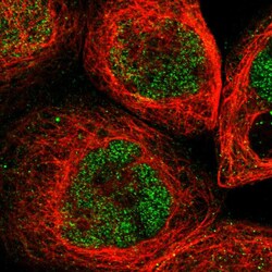 Invitrogen Ubinuclein 2 Polyclonal Antibody 100 &mu;L; Unconjugated:Antibodies,