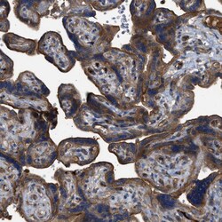 Invitrogen Tara Polyclonal Antibody 100 &mu;L; Unconjugated:Antibodies,