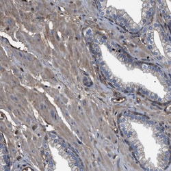 Invitrogen Tara Polyclonal Antibody 100 &mu;L; Unconjugated:Antibodies,