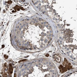 Invitrogen Tara Polyclonal Antibody 100 &mu;L; Unconjugated:Antibodies,