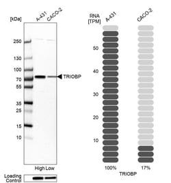 Invitrogen Tara Polyclonal Antibody 100 &mu;L; Unconjugated:Antibodies,
