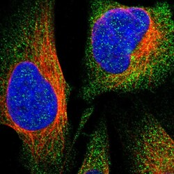 Invitrogen AKAP13 Polyclonal Antibody 100 &mu;L; Unconjugated:Antibodies,