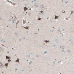Invitrogen AKAP13 Polyclonal Antibody 100 &mu;L; Unconjugated:Antibodies,