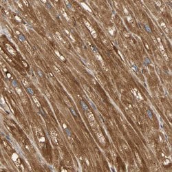 Invitrogen AKAP13 Polyclonal Antibody 100 &mu;L; Unconjugated:Antibodies,