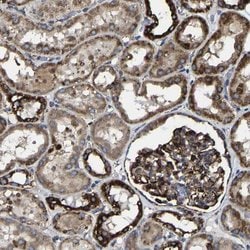Invitrogen NDUFV3 Polyclonal Antibody 100 &mu;L; Unconjugated:Antibodies,
