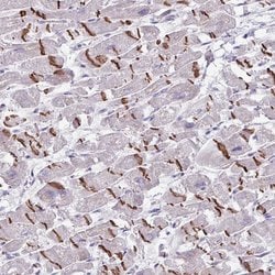 Invitrogen FTSJ2 Polyclonal Antibody 100 &mu;L; Unconjugated:Antibodies,