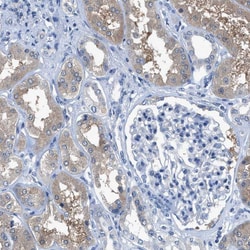 Invitrogen NUDT5 Polyclonal Antibody 100 &mu;L; Unconjugated:Antibodies,