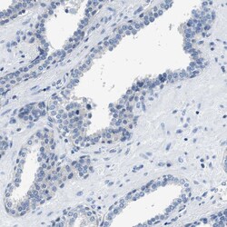 Invitrogen NUDT5 Polyclonal Antibody 100 &mu;L; Unconjugated:Antibodies,