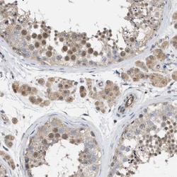 Invitrogen NAPE PLD Polyclonal Antibody 100 &mu;L; Unconjugated:Antibodies,