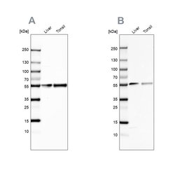Invitrogen GC Polyclonal Antibody 100 &mu;L | Buy Online | Invitrogen&trade; | Fisher Scientific