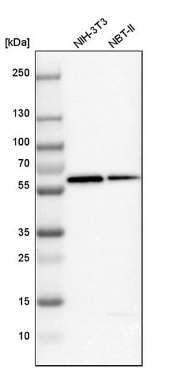 Invitrogen GC Polyclonal Antibody 100 &mu;L | Buy Online | Invitrogen&trade; | Fisher Scientific