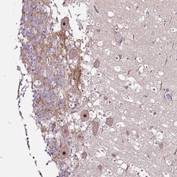 Invitrogen NOM1 Polyclonal Antibody 100 &mu;L; Unconjugated:Antibodies,