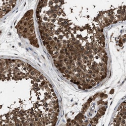 Invitrogen PPA1 Polyclonal Antibody 100 &mu;L; Unconjugated:Antibodies,