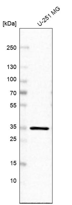 Invitrogen PPA1 Polyclonal Antibody 100 &mu;L; Unconjugated:Antibodies,