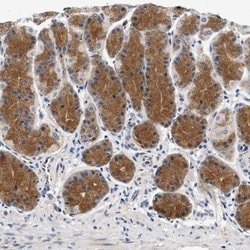 Invitrogen PPM1L Polyclonal Antibody 100 &mu;L; Unconjugated:Antibodies,