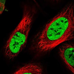 Invitrogen DBC1 Polyclonal Antibody 100 &mu;L; Unconjugated:Antibodies,
