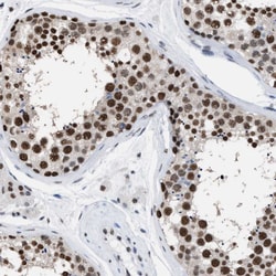 Invitrogen DBC1 Polyclonal Antibody 100 &mu;L; Unconjugated:Antibodies,