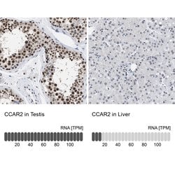 Invitrogen DBC1 Polyclonal Antibody 100 &mu;L; Unconjugated:Antibodies,