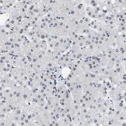 Invitrogen DBC1 Polyclonal Antibody 100 &mu;L; Unconjugated:Antibodies,