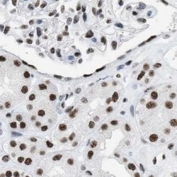 Invitrogen DBC1 Polyclonal Antibody 100 &mu;L; Unconjugated:Antibodies,