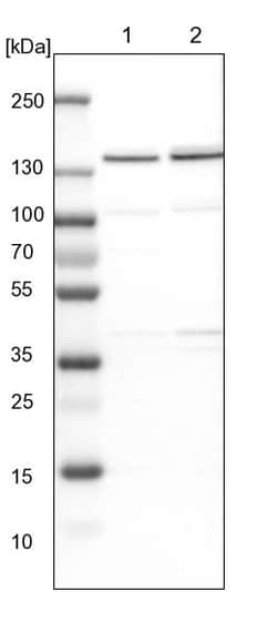 Invitrogen DBC1 Polyclonal Antibody 100 &mu;L; Unconjugated:Antibodies,