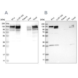 Invitrogen DBC1 Polyclonal Antibody 100 &mu;L; Unconjugated:Antibodies,