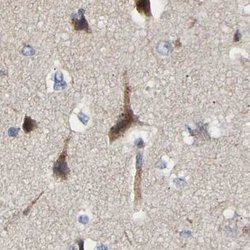 Invitrogen CCDC155 Polyclonal Antibody 100 &mu;L; Unconjugated:Antibodies,