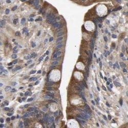 Invitrogen CCDC155 Polyclonal Antibody 100 &mu;L; Unconjugated:Antibodies,