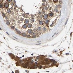 Invitrogen CCDC155 Polyclonal Antibody 100 &mu;L; Unconjugated:Antibodies,