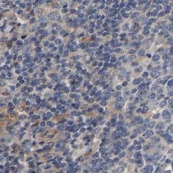 Invitrogen CCDC155 Polyclonal Antibody 100 &mu;L; Unconjugated:Antibodies,