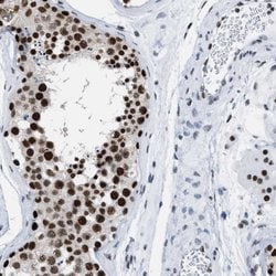 Invitrogen DBC1 Polyclonal Antibody 100 &mu;L; Unconjugated:Antibodies,