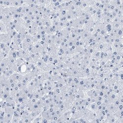 Invitrogen DBC1 Polyclonal Antibody 100 &mu;L; Unconjugated:Antibodies,