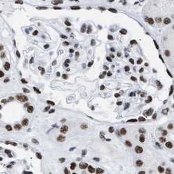 Invitrogen DBC1 Polyclonal Antibody 100 &mu;L; Unconjugated:Antibodies,