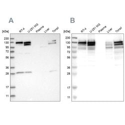 Invitrogen DBC1 Polyclonal Antibody 100 &mu;L; Unconjugated:Antibodies,